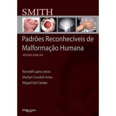 Imagem de Smith padroes reconheciveis de malformacao humana - NoBrand