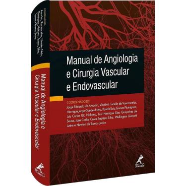 Imagem de Manual De Angiologia E Cirurgia Vascular E Endovascular