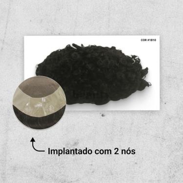 Imagem de Protese Capilar Hibrida Cacheada Dm - Micropele + Tela Lace (20X25)