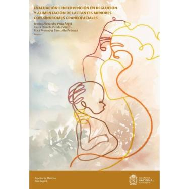 Imagem de Evaluación e intervención en deglución y alimentación de lactantes menores con síndromes craneofacia