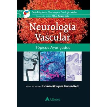 Imagem de Livro - Neurologia Vascular