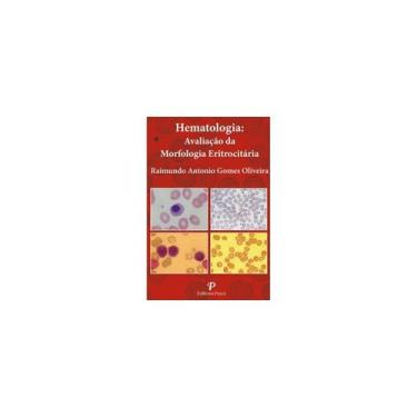 Imagem de Livro - Hematologia: Avaliação Da Morfologia Eritrocitária (Pranchas)