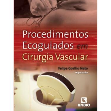 Imagem de Procedimentos Ecoguiados Em Cirurgia Vascular