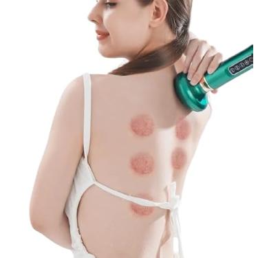 Imagem de Dispositivo de Ventosaterapia Elétrico com Aquecimento Infravermelho, 12 Níveis de Sucção, Bateria 1800mAh, Verde