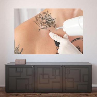 Imagem de Painel Adesivo de Parede - Remoção de Tatuagem - 1202pnp - Allodi