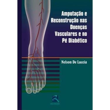 Imagem de Amputacao E Reconstrucao Nas Doencas Vasculares E No Pe Diabetico